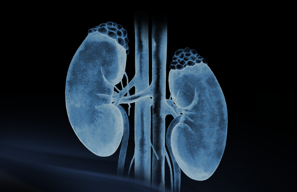 世界腎臟日 | 相得「腎」歡，融有術(shù)、精準(zhǔn)適形